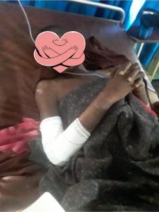 Read more about the article John’s operation was successful.