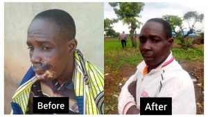 Read more about the article Bulus’ recovery